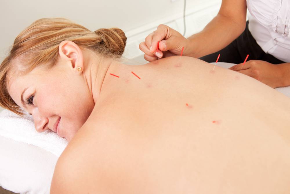 Comment stimuler les points d'acupuncture ?-1