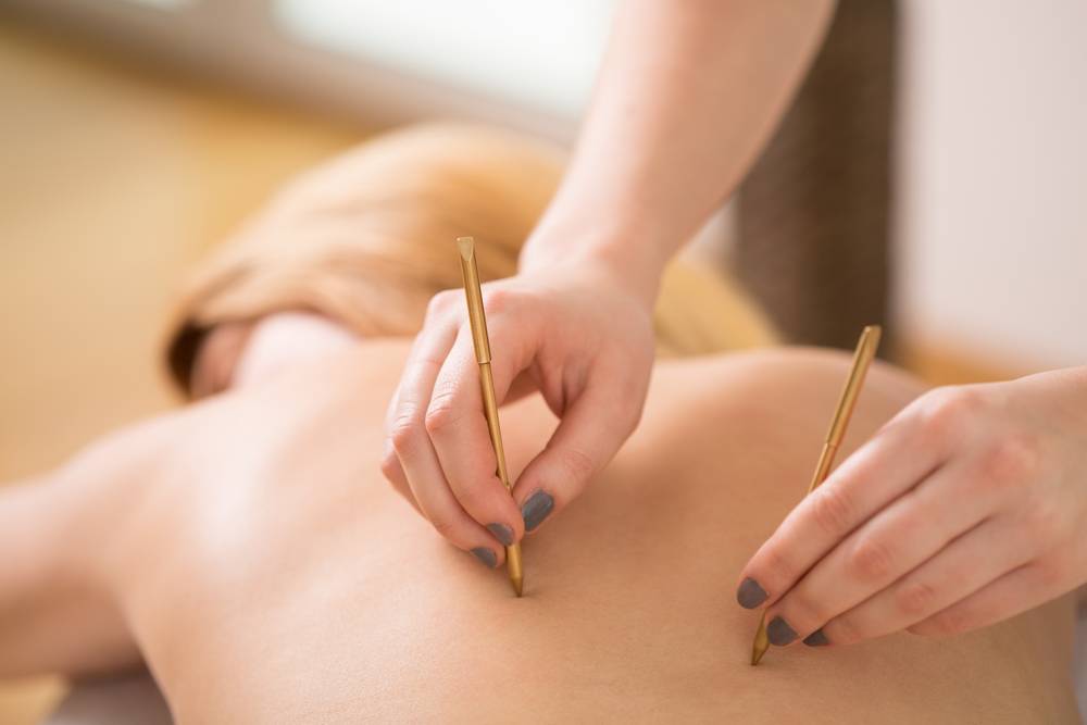 Comment trouver des points d'acupuncture ?-1