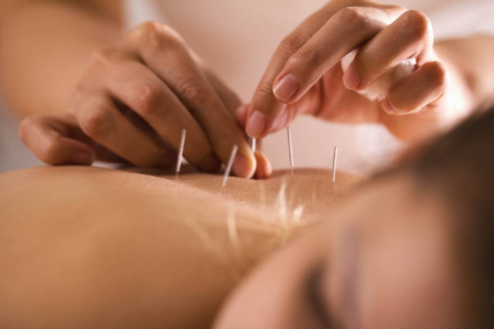 Quelles sont les différences entre acupression et acupuncture ?-1