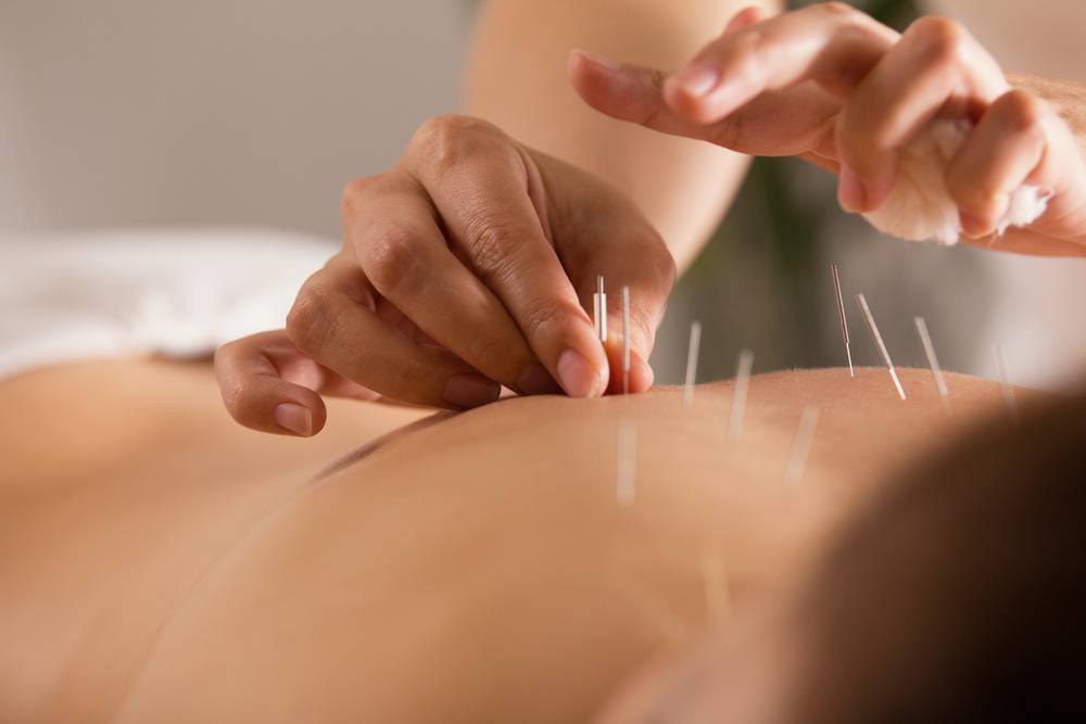 Quelles sont les différences entre acupression et acupuncture ?-2